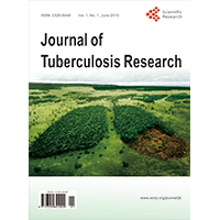 tb research articles